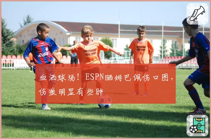 血洒球场！ESPN晒姆巴佩伤口图，伤痕明显有些肿